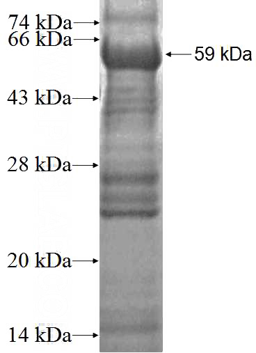 Recombinant Human PD-ECGF SDS-PAGE