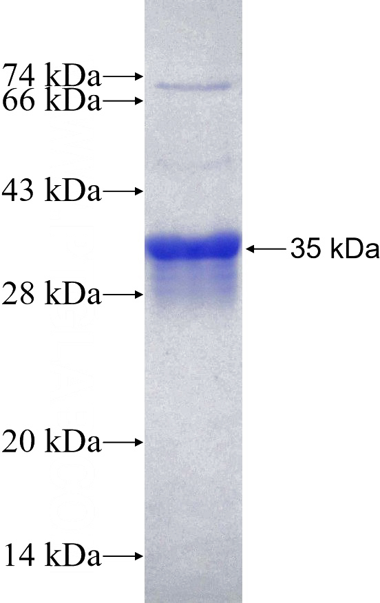 Recombinant Human EMR1 SDS-PAGE