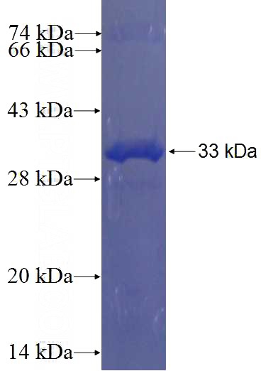 Recombinant Human UBL5 SDS-PAGE