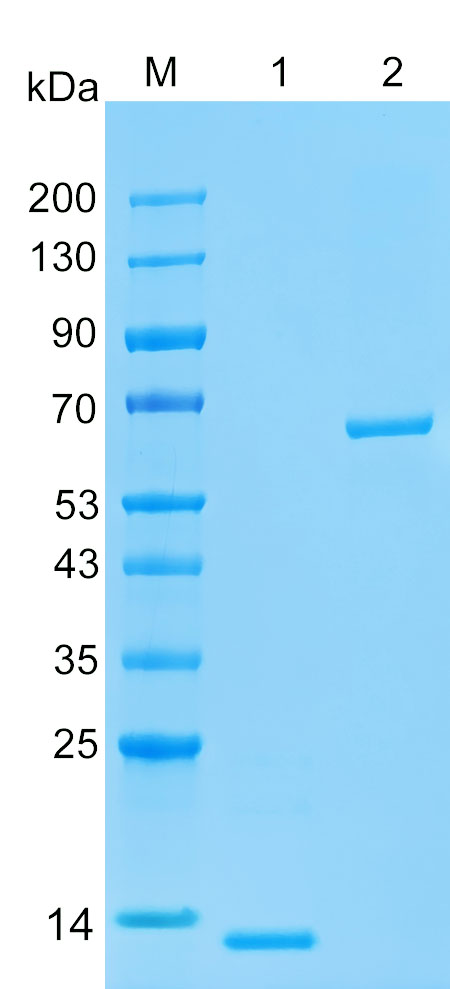 Recombinant SSBP2 protein (His tag) SDS-PAGE