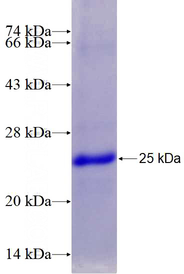 Recombinant Human TRPM8 SDS-PAGE