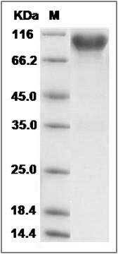Cynomolgus FGFR4 / FGF Receptor 4 Protein (Fc Tag) SDS-PAGE