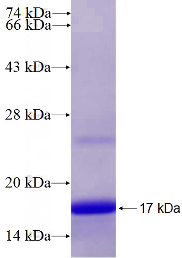 Recombinant Human CTNND2 SDS-PAGE