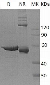 Human G6PD (His tag) recombinant protein