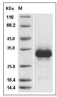 Rat TNFRSF11A Protein (His Tag) SDS-PAGE