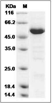 Human HDAC4 Protein (aa 612-1084) SDS-PAGE