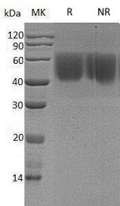 Human CD86/CD28LG2 (His tag) recombinant protein