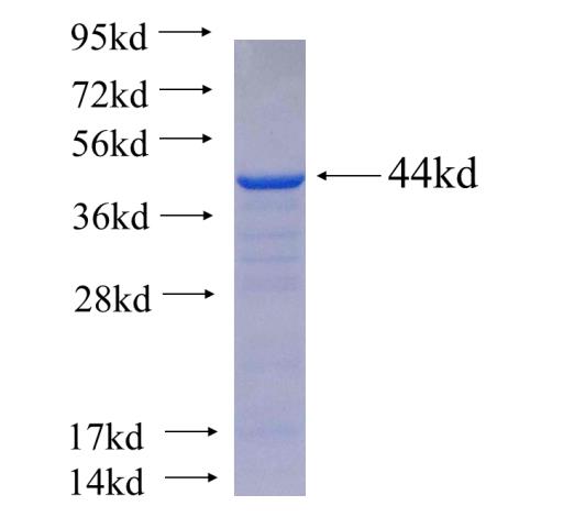 Recombinant human PIGT SDS-PAGE