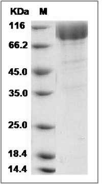 Cynomolgus PDGFRB / PDGFR-1 Protein (His Tag) SDS-PAGE
