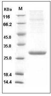 Mouse Serum amyloid P component / APCS / SAP Protein (His Tag) SDS-PAGE
