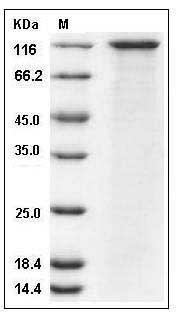 Human SorCS1 Protein (His Tag) SDS-PAGE
