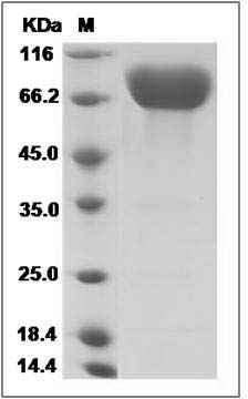 Rat PD-L1 / B7-H1 / CD274 Protein (Fc Tag) SDS-PAGE