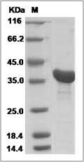 Mouse FDPS Protein (His Tag) SDS-PAGE