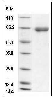 Mouse DPP7 / DPPII / DPP2 Protein (His Tag) SDS-PAGE