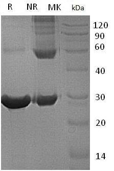 Human TXLNA/TXLN (His tag) recombinant protein