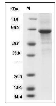 Human DKKL1 / Soggy-1 / SGY-1 Protein (Fc Tag) SDS-PAGE