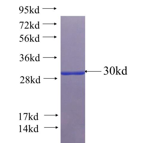 Recombinant Arabidopsis thaliana PYL10 SDS-PAGE