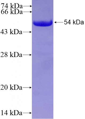 Recombinant Human EFS SDS-PAGE