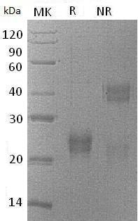 Mouse Il7/Il-7 (His tag) recombinant protein