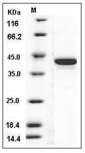 Human STK10 / LOK Protein (His Tag) SDS-PAGE