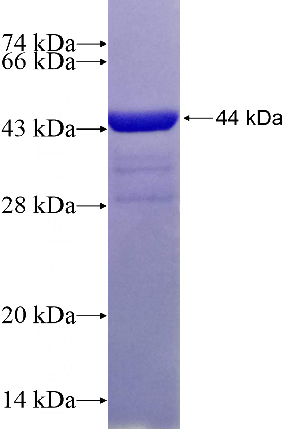 Recombinant Human RPL12 SDS-PAGE