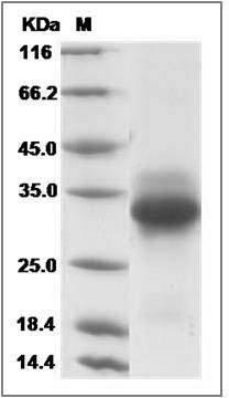 Canine CD40 / TNFRSF5 Protein (His Tag) SDS-PAGE