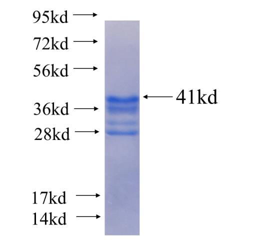 Recombinant human RPL35(Full length) SDS-PAGE