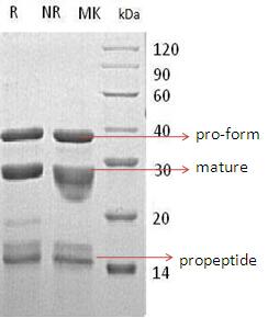 Human CTSS (His tag) recombinant protein