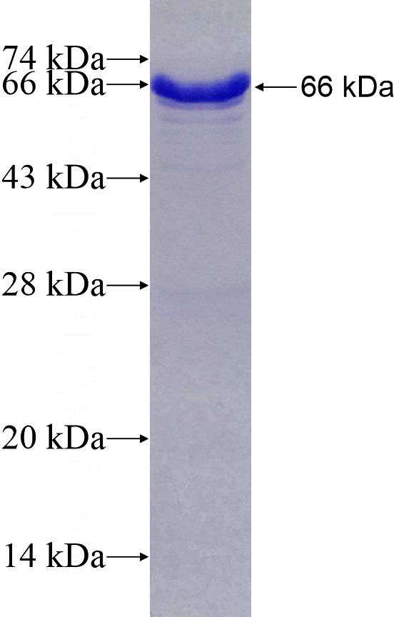 Recombinant Human WDR24 SDS-PAGE