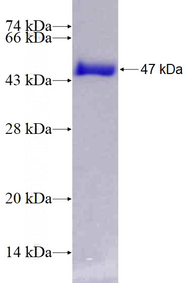 Recombinant Human MED18 SDS-PAGE