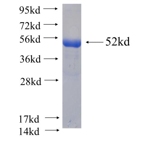 Recombinant human KCTD5(Full length) SDS-PAGE
