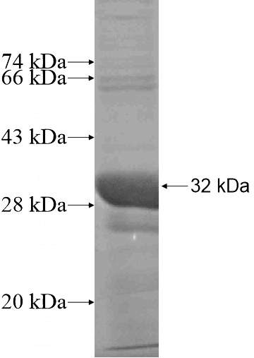 Recombinant Human SPIN2B SDS-PAGE