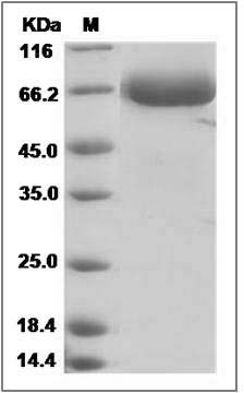 Influenza A H7N9 (A/Zhejiang/ DTID-ZJU10/2013) Hemagglutinin / HA Protein (His Tag) SDS-PAGE