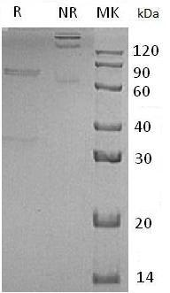 Human CTGF/CCN2/HCS24/IGFBP8 (Fc tag) recombinant protein