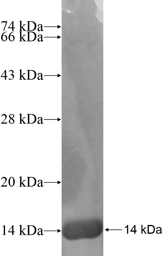 Recombinant Human NUMBL SDS-PAGE