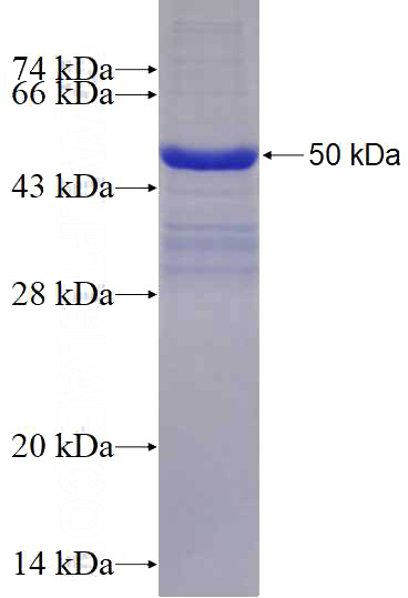 Human Integrin alpha-6 Recombinant protein (GST tag)