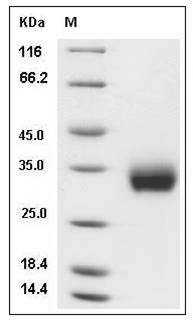 Human ULBP2 / N2DL-2 Protein (His Tag) SDS-PAGE