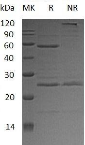 Human ODC1 (His tag) recombinant protein