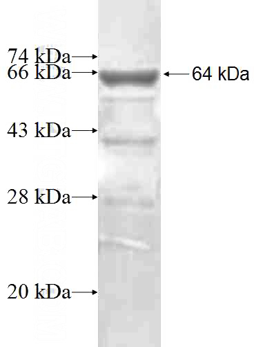 Recombinant Human CDR2L SDS-PAGE