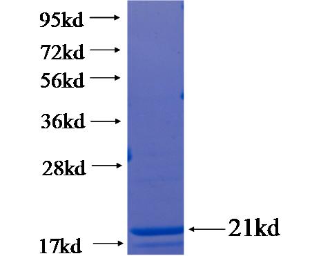 Recombinant human CPS1 SDS-PAGE