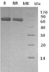 Human EDIL3/Del-1 (His tag) recombinant protein