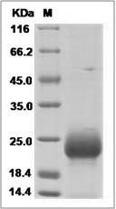 Human FSH Beta / FSHB Protein (His Tag)