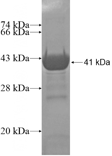 Recombinant Human METT11D1 SDS-PAGE