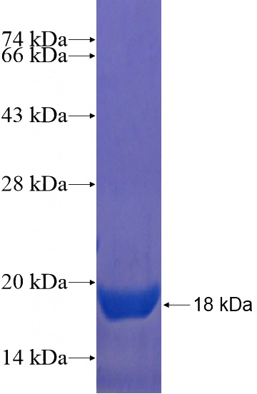 Recombinant Human GLT8D1 SDS-PAGE
