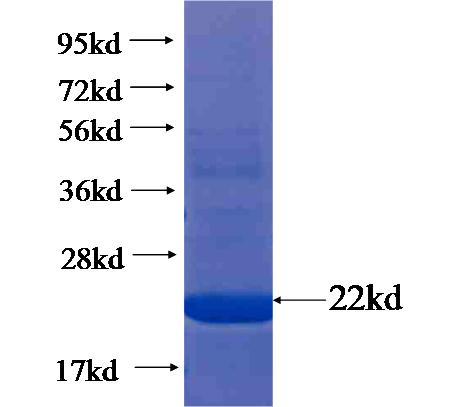 Recombinant human C18orf22 SDS-PAGE