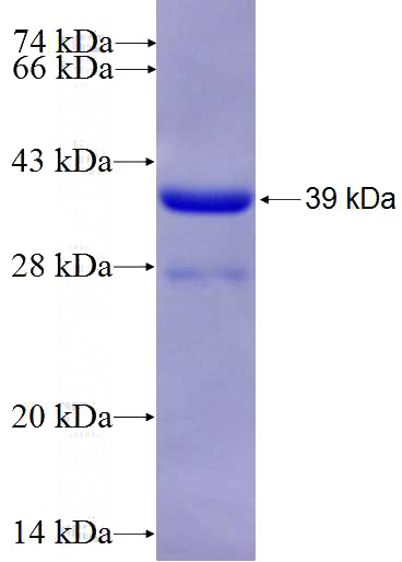 Recombinant Human RPA3 SDS-PAGE