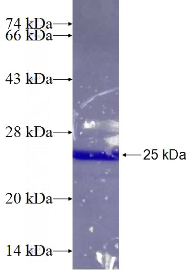 Recombinant Human EIF3A SDS-PAGE