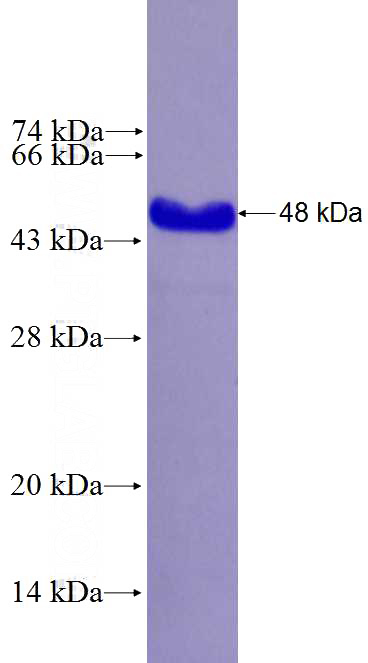Recombinant Human CCDC132 SDS-PAGE