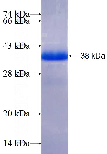 Recombinant Human ARHGAP28 SDS-PAGE