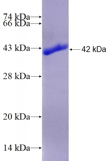 Recombinant Human PRKD1 SDS-PAGE